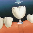 happy dental este clinica de chirurgie oro maxilo faciala si implantologie